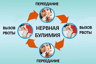 Лечение булимии в Богучаре